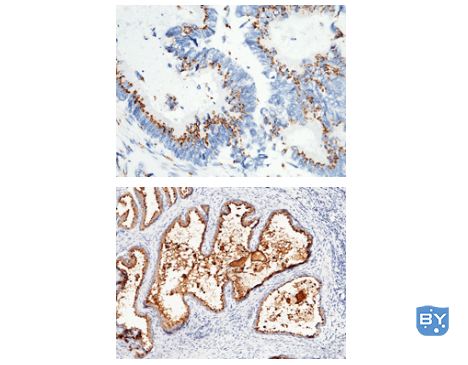 分子实验-什么是免疫组织化学 (IHC)？