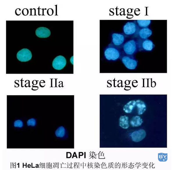 细胞凋亡的形态学检测方法