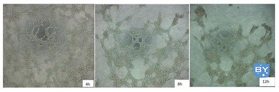 体外血管形成实验步骤（附带实验流程）